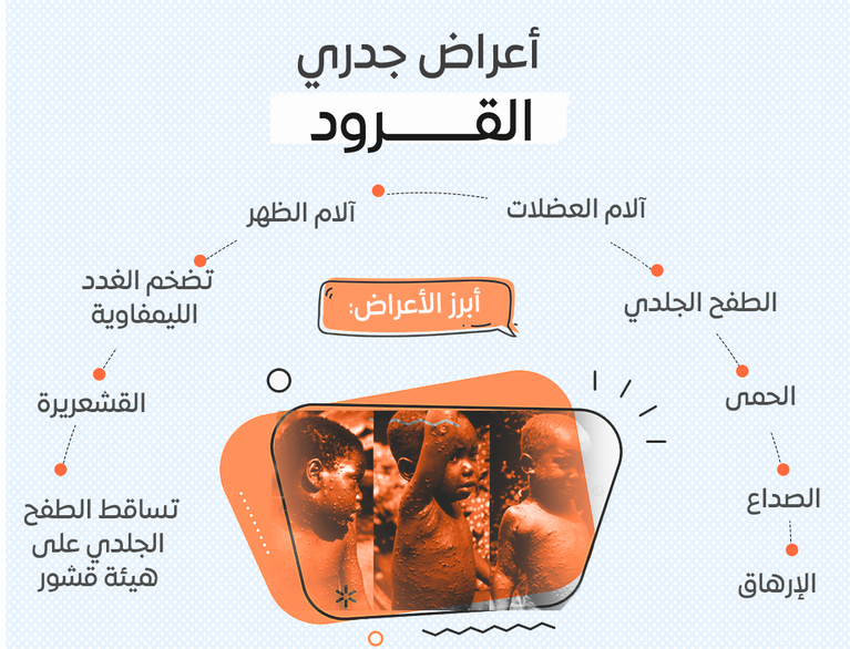 القرود كيف ينتقل. e1653234234824 | موسوعة الشرق الأوسط