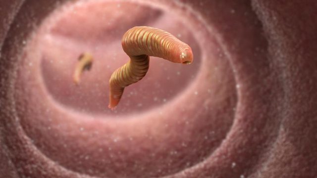 1 hookworms in the intestine tim vernon science photo library | موسوعة الشرق الأوسط