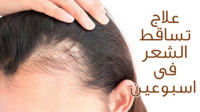 10 خلطات لعلاج تساقط الشعر | موسوعة الشرق الأوسط