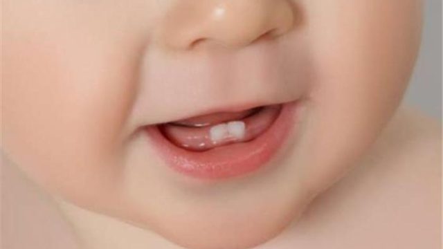 127 222329 causes delayed teething children 700x400 1589011729 | موسوعة الشرق الأوسط