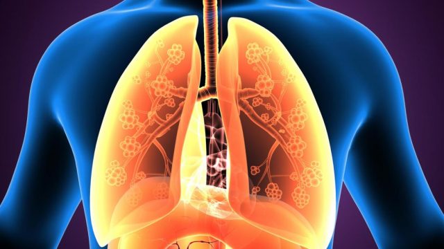 3d model of the lungs and airways | موسوعة الشرق الأوسط