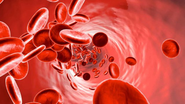 Anemia | موسوعة الشرق الأوسط