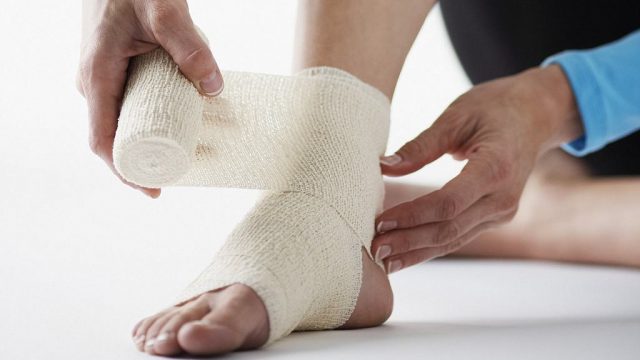 Ankle sprains | موسوعة الشرق الأوسط