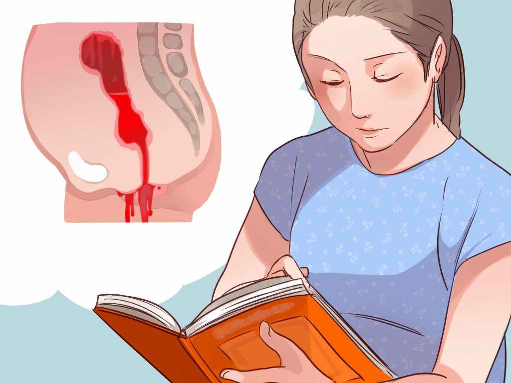 Know if Its Postpartum Bleeding or a Period Step 6 | موسوعة الشرق الأوسط