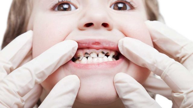 Rotten childs teeth | موسوعة الشرق الأوسط