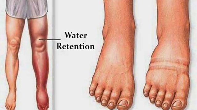 Water retention | موسوعة الشرق الأوسط