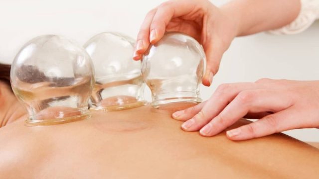 cupping photo | موسوعة الشرق الأوسط