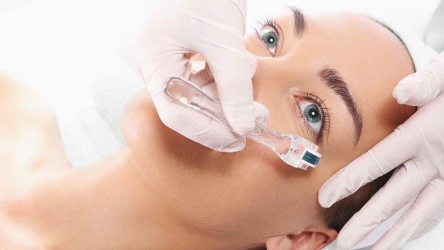 derma roller | موسوعة الشرق الأوسط