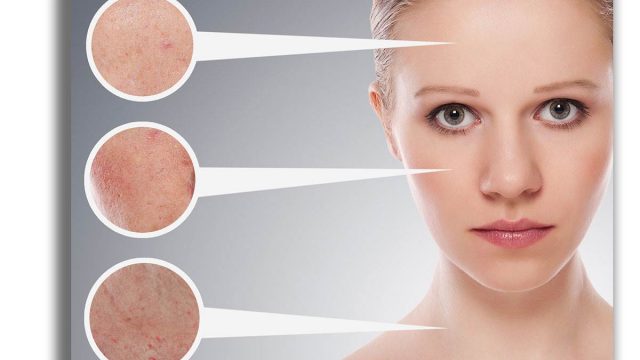 dermatop | موسوعة الشرق الأوسط