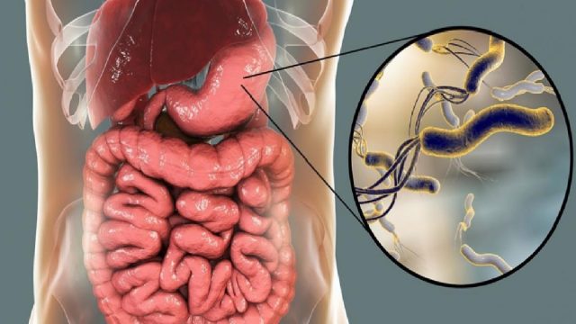 helicobacter pylori mide mikrobu nedir helicobacter pylorinin neden oldugu hastaliklar H3CTGqrH | موسوعة الشرق الأوسط