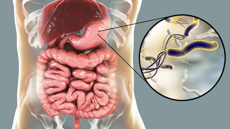 helikobakterija simptomi | موسوعة الشرق الأوسط