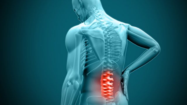 herniateddisc | موسوعة الشرق الأوسط