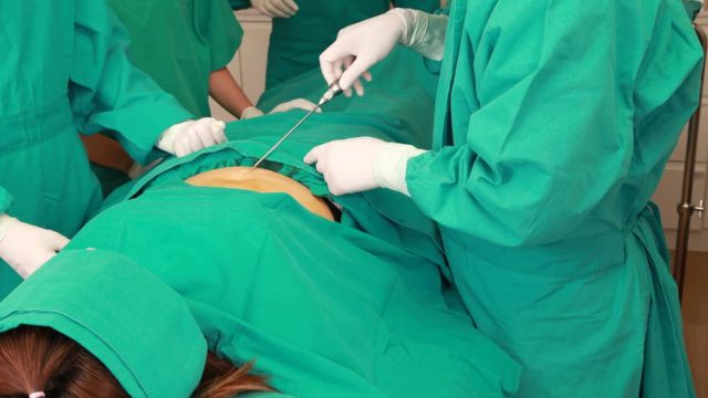 liposuction cannula | موسوعة الشرق الأوسط