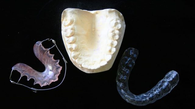 orthodontic 315784 960 720 | موسوعة الشرق الأوسط