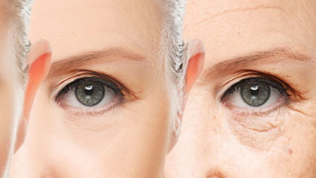 que es la blefaroplastia | موسوعة الشرق الأوسط