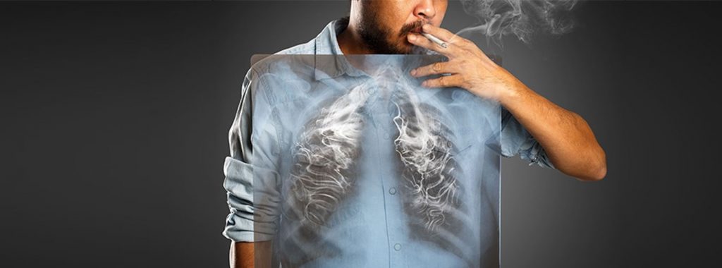 smoking affect our lung function 1 | موسوعة الشرق الأوسط