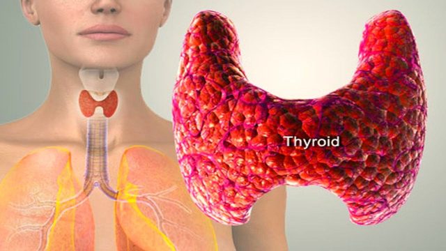 thyroid problem | موسوعة الشرق الأوسط