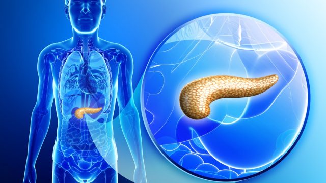 tumore al pancreas | موسوعة الشرق الأوسط