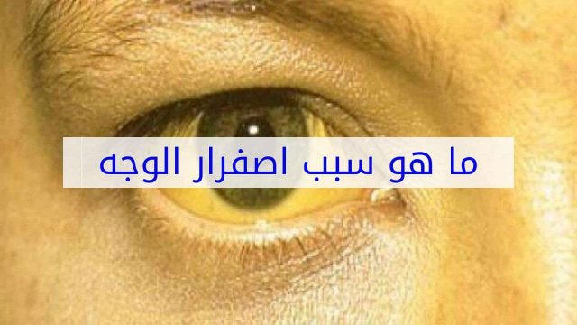 أسباب بوصفير | موسوعة الشرق الأوسط