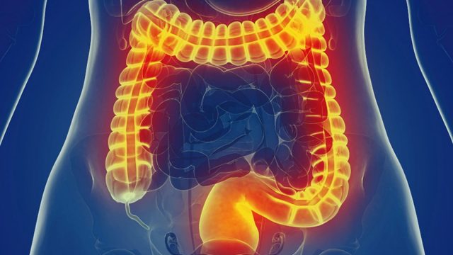 أعراض القولون الهضمي عند النساء | موسوعة الشرق الأوسط