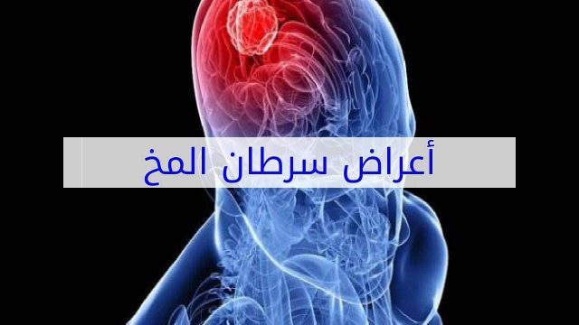 أعراض سرطان المخ | موسوعة الشرق الأوسط