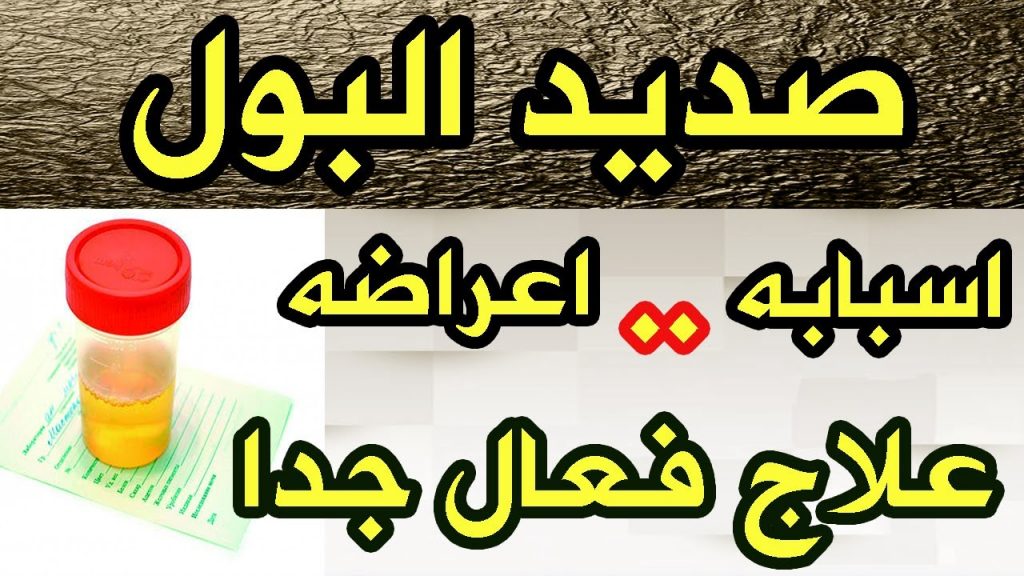 اسباب | موسوعة الشرق الأوسط