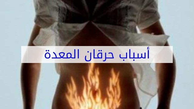 اسباب الحرقان في المعدة | موسوعة الشرق الأوسط