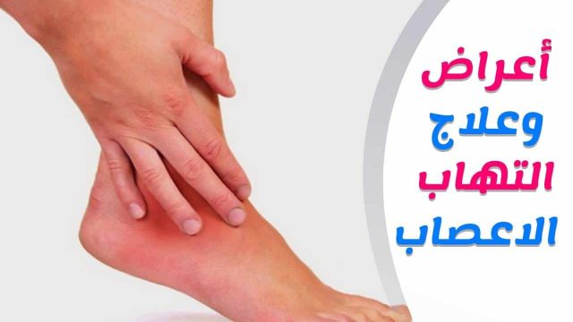 اعراض مرض الاعصاب النفسي | موسوعة الشرق الأوسط