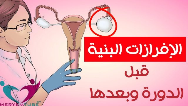 افرازات بنية | موسوعة الشرق الأوسط