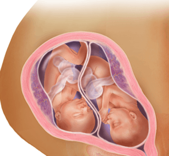 الأسبوع الرابع والعشرين للتوأم داخل الرحم1 | موسوعة الشرق الأوسط