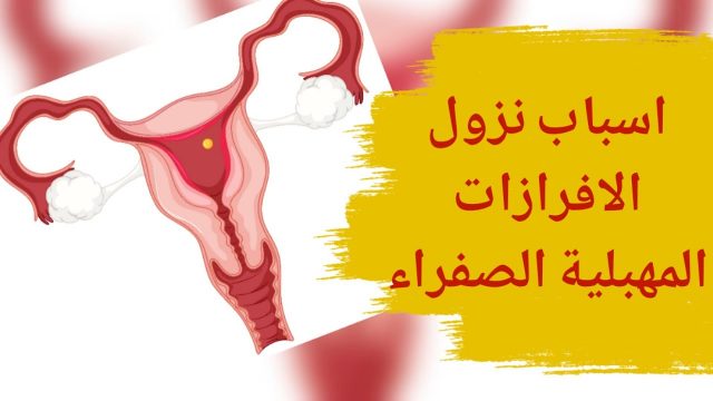 الافرازات الصفراء تدل على ايش | موسوعة الشرق الأوسط