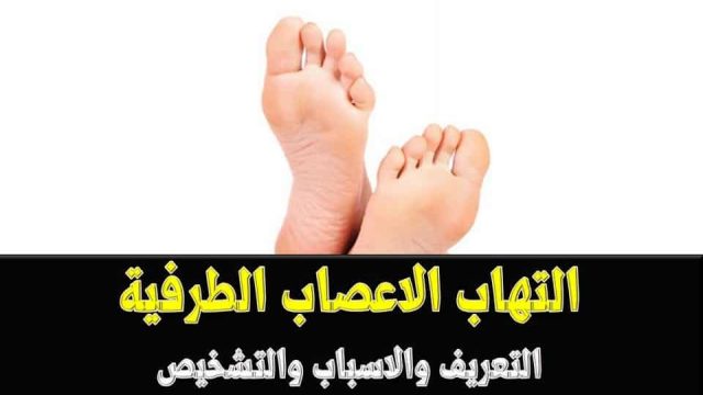 التهاب الاعصاب الطرفية | موسوعة الشرق الأوسط