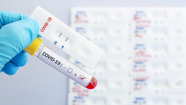 اماكن تحليل pcr جدة فيروس كورونا مع الأسعار | موسوعة الشرق الأوسط