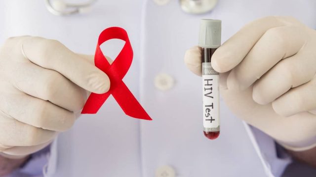 تحليل hiv | موسوعة الشرق الأوسط