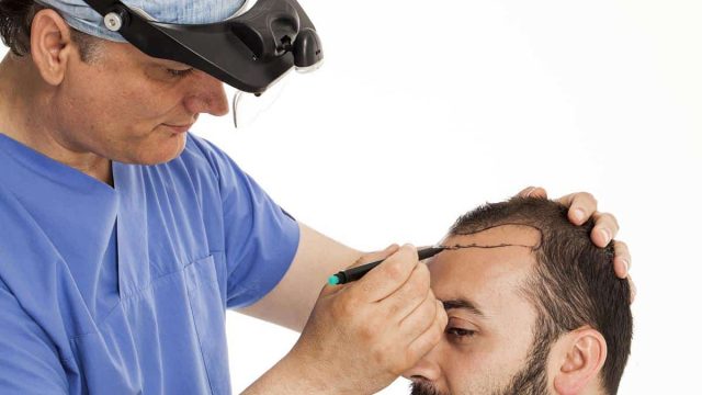 زراعة الشعر في دبي | موسوعة الشرق الأوسط