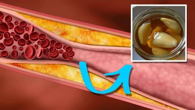 صيام تحليل الدهون الثلاثية | موسوعة الشرق الأوسط