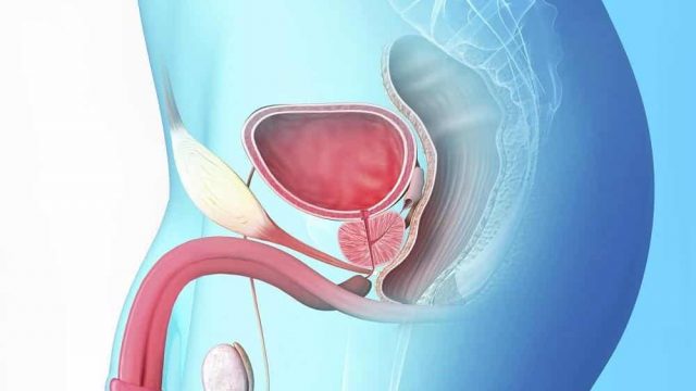 علاج احتقان البروستاتا طبيعيا | موسوعة الشرق الأوسط
