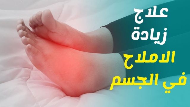 علاج الاملاح في القدمين والنقرس | موسوعة الشرق الأوسط