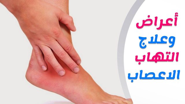 علاج التهاب أعصاب الساقين | موسوعة الشرق الأوسط