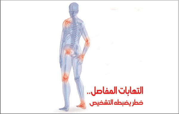 علاج التهاب مفصل الكوع بالاعشاب | موسوعة الشرق الأوسط