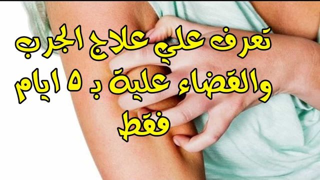 علاج الجرب بزيت الزيتون | موسوعة الشرق الأوسط