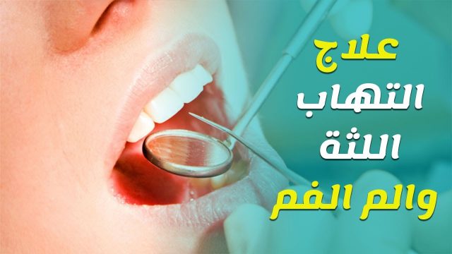 علاج اللثة | موسوعة الشرق الأوسط