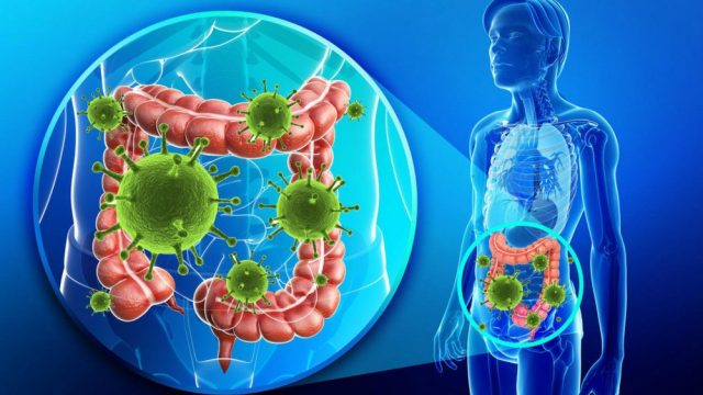 كيف يكون ألم القولون العصبي | موسوعة الشرق الأوسط