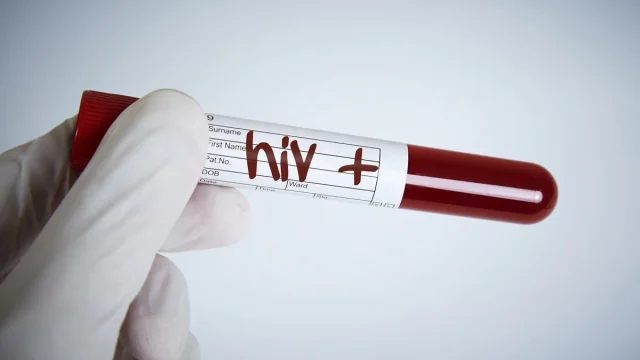 ما هو تحليل HIV AB للحامل | موسوعة الشرق الأوسط