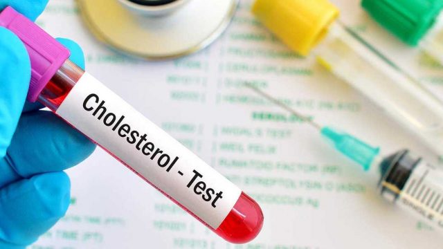 ما هو تحليل LDL cholesterol فحص الكوليسترول الضار | موسوعة الشرق الأوسط