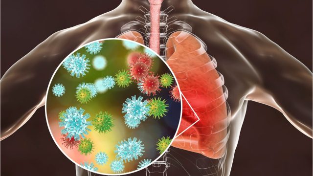 ما هي الأدوية المستخدمة حاليا لعلاج كورونا؟ | موسوعة الشرق الأوسط