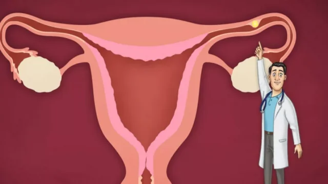 متى ينفجر الحمل خارج الرحم | موسوعة الشرق الأوسط