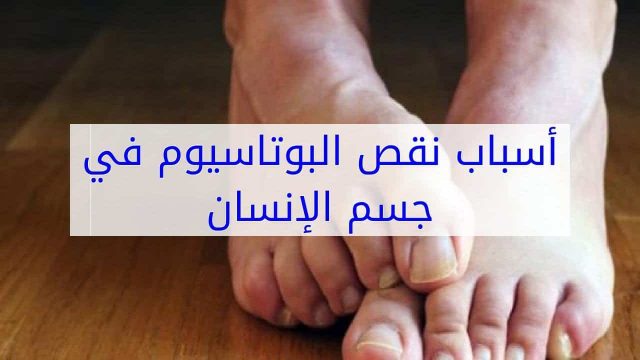 نقص البوتاسيوم في الجسم | موسوعة الشرق الأوسط