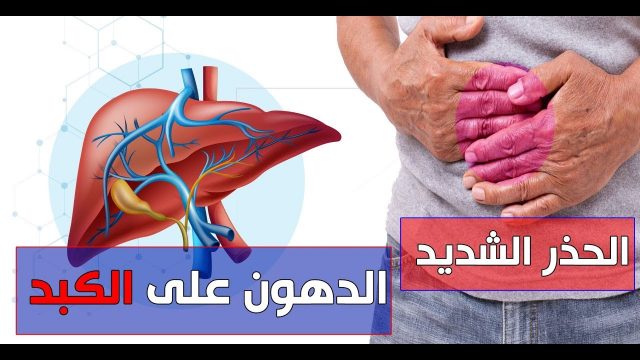 هل دهون الكبد مرض خطير | موسوعة الشرق الأوسط