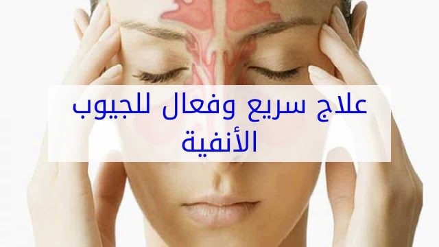 وعاء نيتي | موسوعة الشرق الأوسط